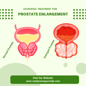 Top Ayurvedic Treatment for Prostate Enlargement (BPH) in Pune & Mumbai – Uttrabasti by Dr. Sunil Kahalekar